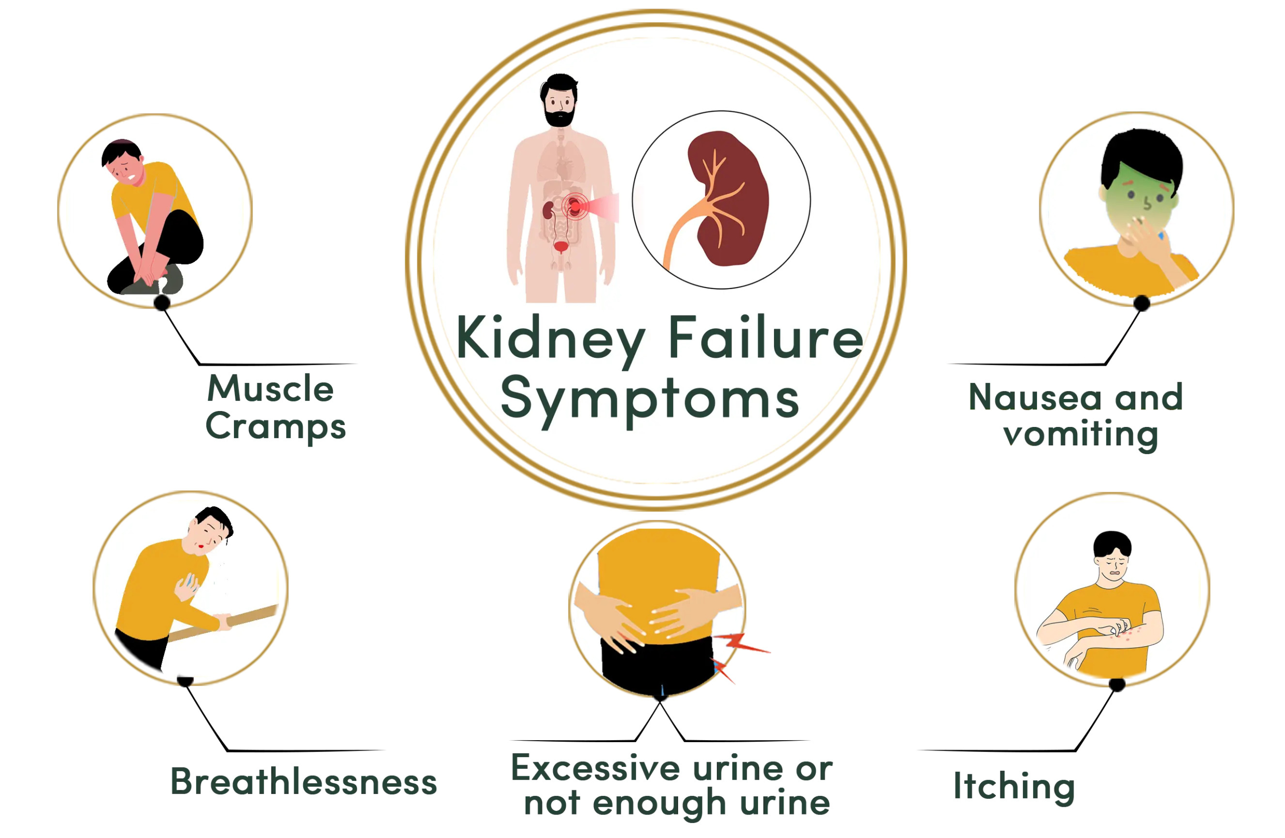 Do You Have Symptoms of Kidney Failure? | American Dialysis ...